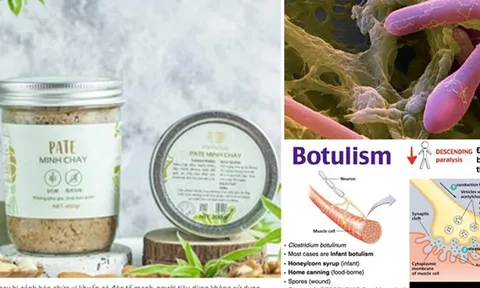 Vi khuẩn Clostridium botulinum được tìm thấy trong Pate Minh Chay chứa độc tố gây chết người